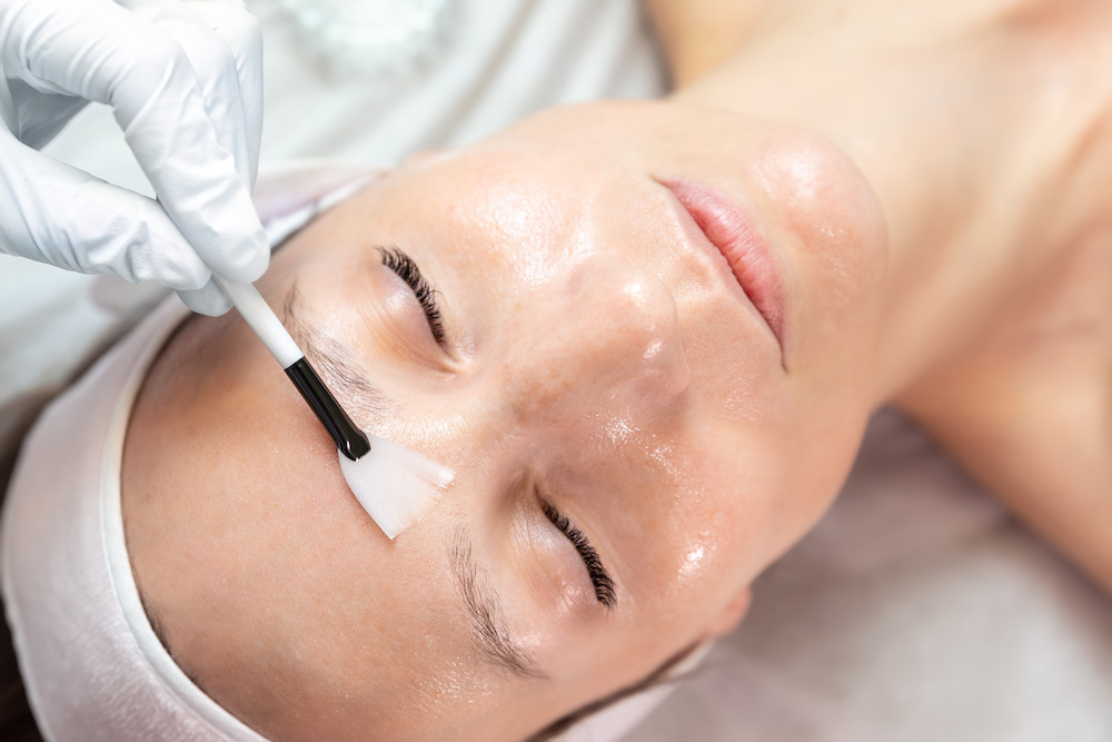 Bellevue Chemical Peels