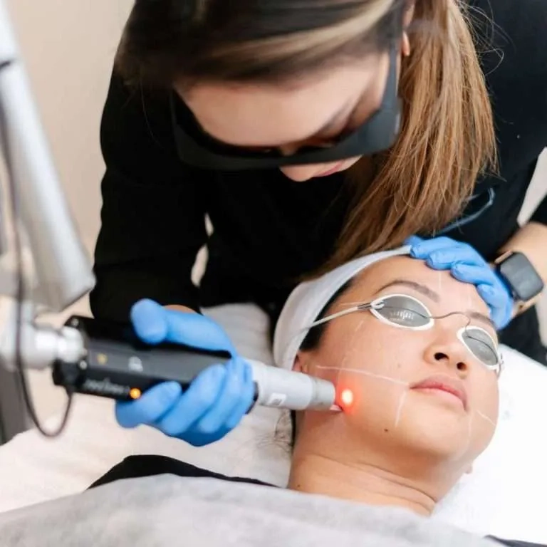the picosure melasma treatment process