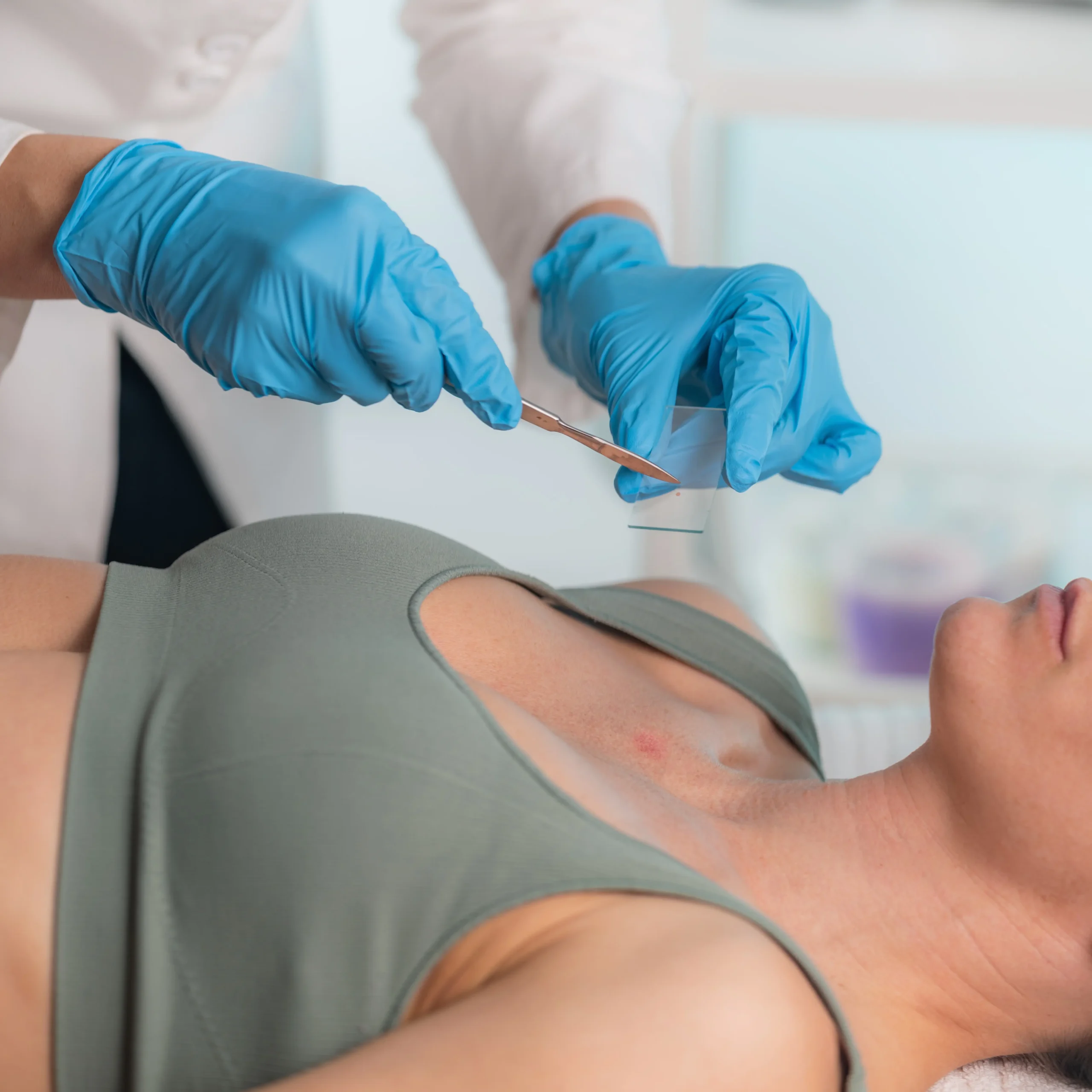 the picosure process what to expect